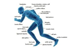 Musculoskeletal physio in Edmonton