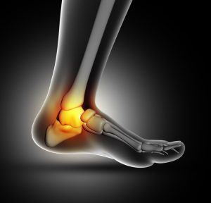 Foot & Ankle Pain Therapy in Edmonton